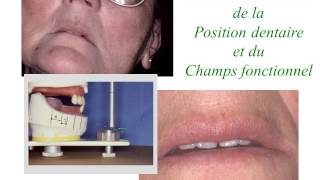 Ortho3 Les 6 clés de lanalyse occlusale [upl. by Acceber]