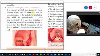 Limiting structures of maxillary arch Part 2 [upl. by Leugimesoj]