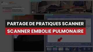 CT Scanner EMBOLIE PULMONAIRE  Partage de pratiques [upl. by Manthei481]