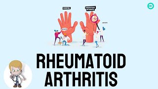 Rheumatoid Arthritis Causes symptoms and Treatment options [upl. by Chevy]