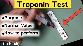 Troponin Test in Hindi  Trop T test Method troponintest nursingcriteria [upl. by Bergess]