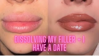 ♡DISSOLVING MY LIP FILLER  MY DATE AT A 2 MICHELIN STAR RESTAURANT ♡  VLOG  HOLLY SCARFONE [upl. by Ecinwahs]