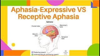 AphasiaExpressive VS Receptive Aphasia  Fluent amp NonFluent Aphasia  PhysiotherapyKnowledge [upl. by Hermie]