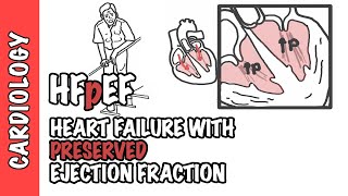 HFpEF  Heart Failure with Preserved Ejection Fraction [upl. by Yruam404]