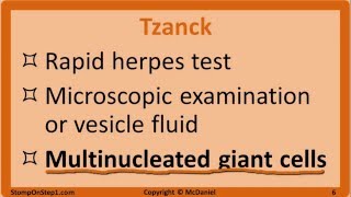 Herpes Mono HSV Chickenpox Shingles EBV CMV Cold Sore VZV Varicella [upl. by Orihakat]