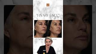 Fix My Face Filler Package [upl. by Godric]