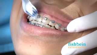 Orthodontic Home Care Instructions  Braces  Brushing [upl. by Aliuqahs]