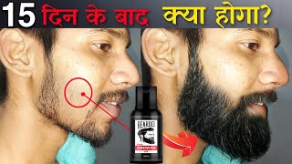 Beardo Hair Growth Oil After 15 Days Review  Best Beard Oil For Patchy Beard in India 2022 [upl. by Nuarb257]