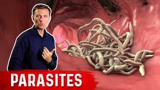 The Best Herbs for Parasites [upl. by Adena]