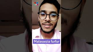 Dandruff  খুশকি  Fungal infection  Malassezia furfur  Dr Med  Sakib Rahaman [upl. by Pitt709]