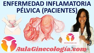 ENFERMEDAD INFLAMATORIA PÉLVICA EPI PACIENTES síntomas y tratamiento Ginecología y Obstetricia [upl. by Afaw]