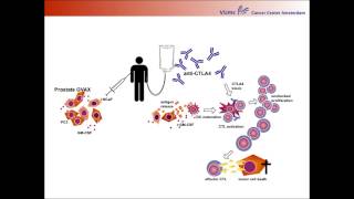 Immune Biomarkers for Patients Selection in Immunotherapy of Prostate Cancer [upl. by Calva]