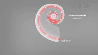 Temporal Coding With FineHearing®  MEDEL [upl. by Andra]