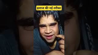 इलाज की नई तरीका comedy funny fun memes marathicomedy lakhanghotkar facebook reels [upl. by Gavrila]