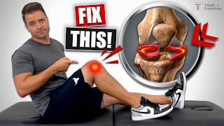 Fix Meniscus Tear Without Surgery Knee Pain Relief Exercises [upl. by Airdnassac]