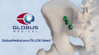 SILOK® SELECT Sacroiliac Joint Fusion System [upl. by Oiramrej896]