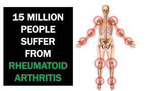 Natural Remedies For Rheumatoid Arthritis That Work [upl. by Goodill]