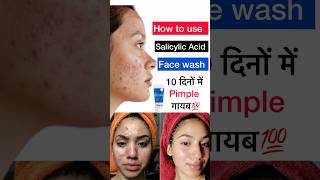 salicylic acid facewash का उपयोग कैसे क़रे salicylic acid facewash के फायदे salicylicacidfacewash [upl. by Verneuil]