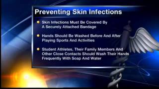 Ways to avoid MRSA amp staph infections [upl. by Isabella386]