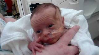 Lillians first bottle feeding and she hit 3 lbs NICU Premature baby [upl. by Englis951]