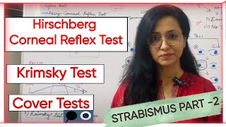 Strabismus Part 2  Hirschberg Corneal Reflex Test  Krimsky Test  Cover Tests [upl. by Gavin]