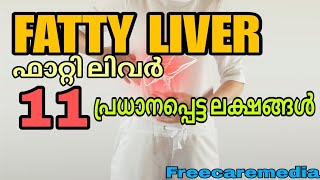 Fatty liver symptoms malayalam  liverdisease liver liverdiseasesymptoms [upl. by Alekim]