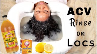 My FIRST ACV Rinse for Locs  Naturally Michy [upl. by Kahcztiy]