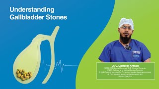 Understanding Gallbladder Stones  Kamineni Hospitals  Kingkoti [upl. by Aima16]