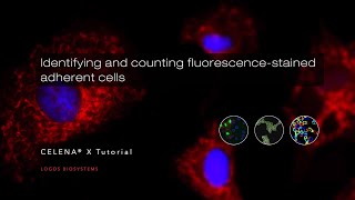 Identifying and counting fluorescencestained adherent cells [upl. by Solomon]