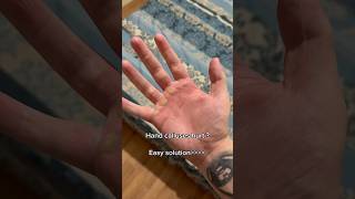 Protein  workout callus calluses gym calisthenics bars arms hurt [upl. by Aiyt968]