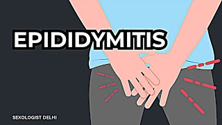 Epididymitis यह नामर्द बना देता है [upl. by Hyozo]