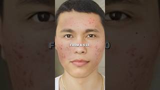 Zuniga on Natural Face Mask Glow Up in 7 Days [upl. by Niwre]