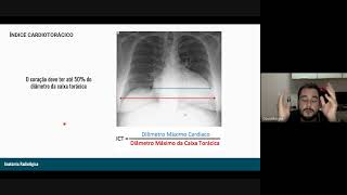 RADIOGRAFIA DE TÓRAX TÉCNICA  ANATOMIA E INTERPRETAÇÃO [upl. by Silvain]