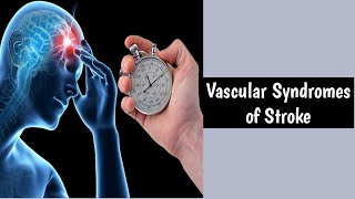 Vascular Syndromes Of StrokeStroke SyndromesTypes Of Stroke SyndromesVascular Stroke [upl. by Ennaeiluj]