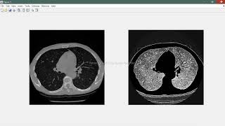 Gaussian windowing Matlab  Medical image processing 2 [upl. by Ainatit]