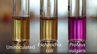 Demo Biochemical Tests  Urease Test [upl. by Nicky311]