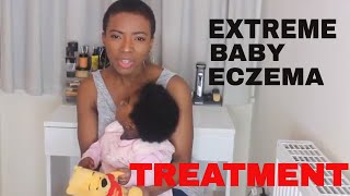 EXTREME BABY ECZEMA TREATMENT [upl. by Ltney]