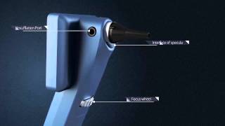 EOC 100 Digital Ototoscope [upl. by Areid]