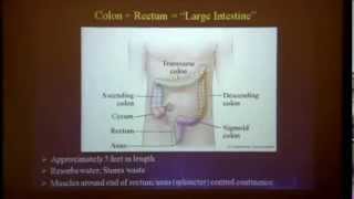 Whats Involved with Colon Cancer Surgery [upl. by Heiner]