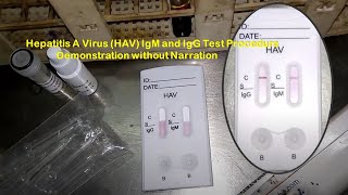 Hepatitis A Virus HAV IgM and IgG Test Procedure Demonstration without Narration [upl. by Chaffee]