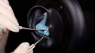 ASMR  Up close EAR CLEANING no talking Sensory Sunday [upl. by Martz]