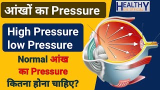 iop  आंखों का प्रेशर क्या होता है  Intraocular pressure  Glucoma in eye  काला मोतिया [upl. by Kirkwood]