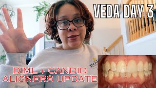 Candid Dental Aligners Update My Tooth Is Not Shifting VEDA Day 3 2024 [upl. by Moersch627]