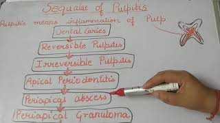 Pulpitissequalaeofpulpitislecture1dentalnotes [upl. by Noisla]