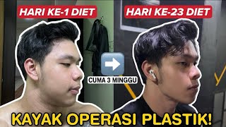 DIKIRA OPERASI PLASTIK MUKA BERUBAH CUMA 23 HARI [upl. by Maddeu224]