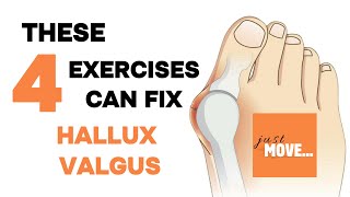 Hallux Valgus Exercises  no equipment  follow along  building up the arch of the foot [upl. by Nibram]