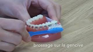 Comment brosser ses dents avec un appareil [upl. by Careaga]