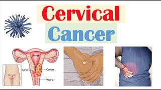 Cervical Cancer Risk Factors Pathophysiology Symptoms Staging Diagnosis Treatment amp Prevention [upl. by Whitson]