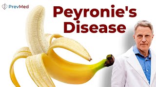 Peyronie’s Disease Is Your Penis Warning You About Type 2 Diabetes [upl. by Pangaro]