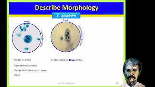 Diagnostic Parasitology Entamoeba gingivalis Naeflaria fowleri Balamuthia and Acanthamoeba [upl. by Lily]